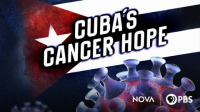 Cuba_s_Cancer_Hope