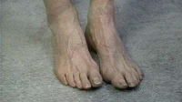Foot_assessment_and_care