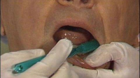 Mouth_care_of_the_resident